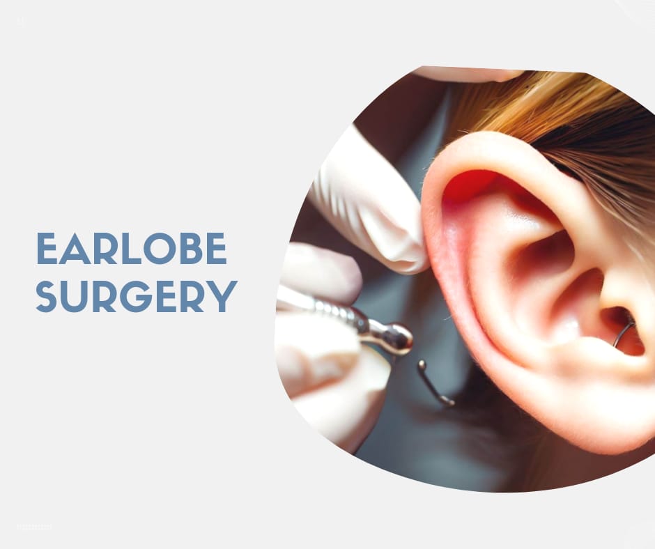 ear lobe surgery